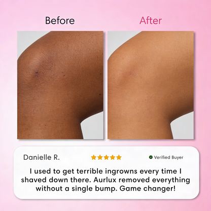 Intimate Hair Removal Kit