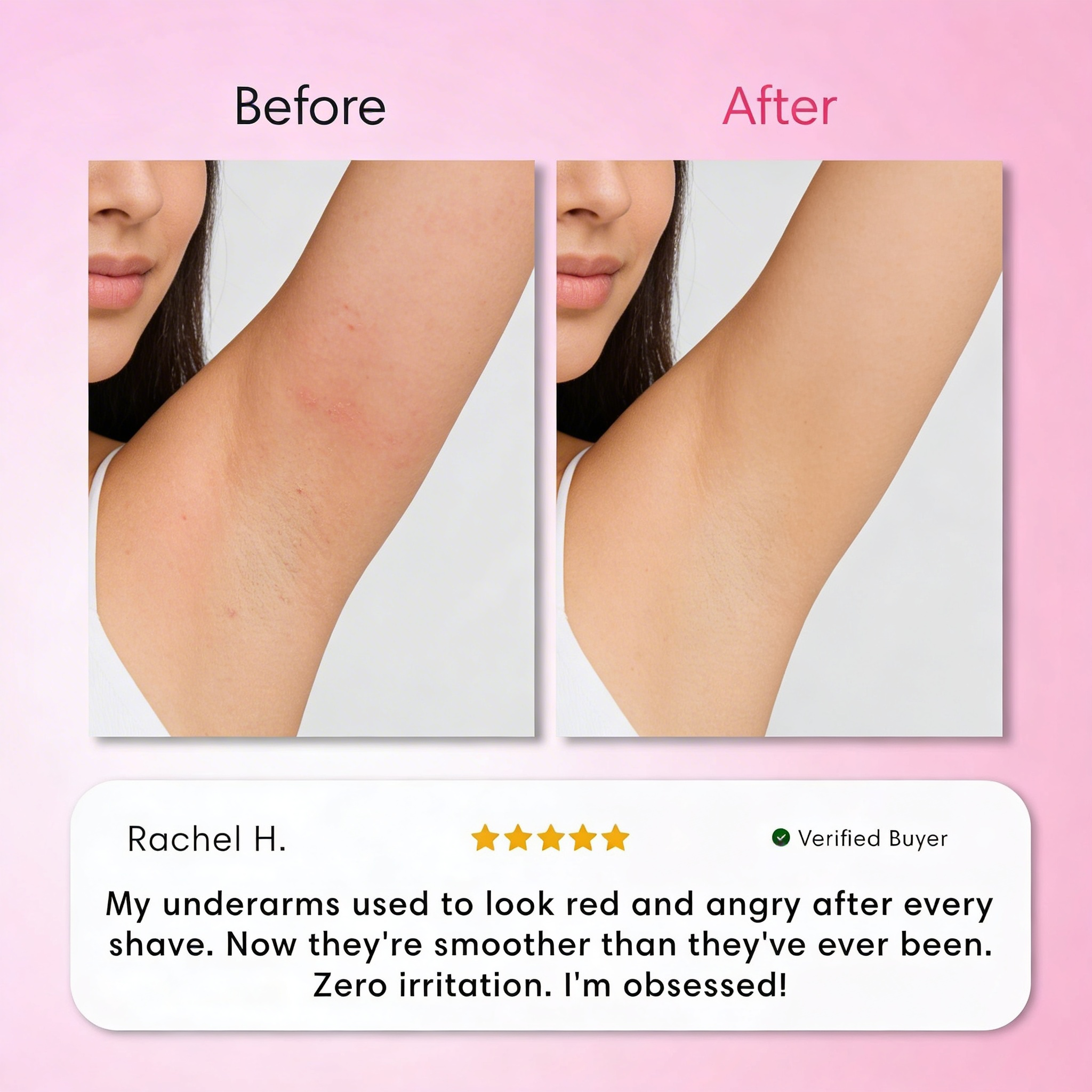Intimate Hair Removal Kit