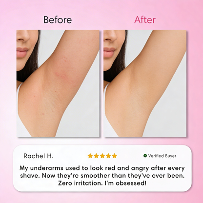 Intimate Hair Removal Kit